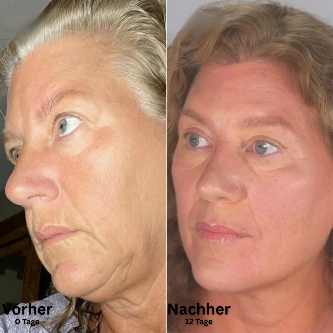 SkinFort Lymphkontur Bürste