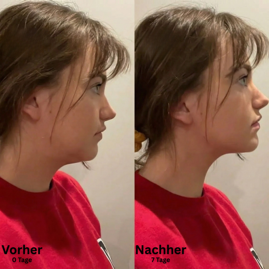 SkinFort Lymphkontur Bürste