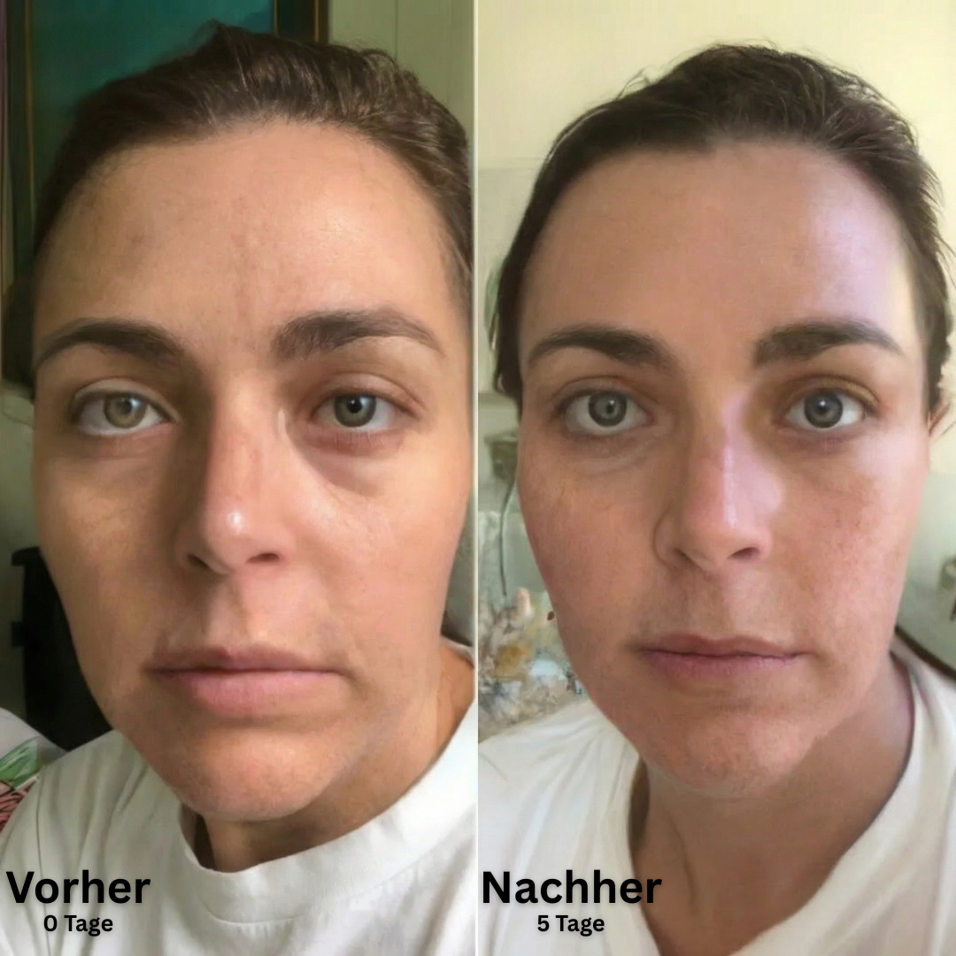 SkinFort Lymphkontur Bürste