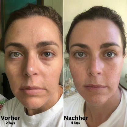 SkinFort Lymphkontur Bürste