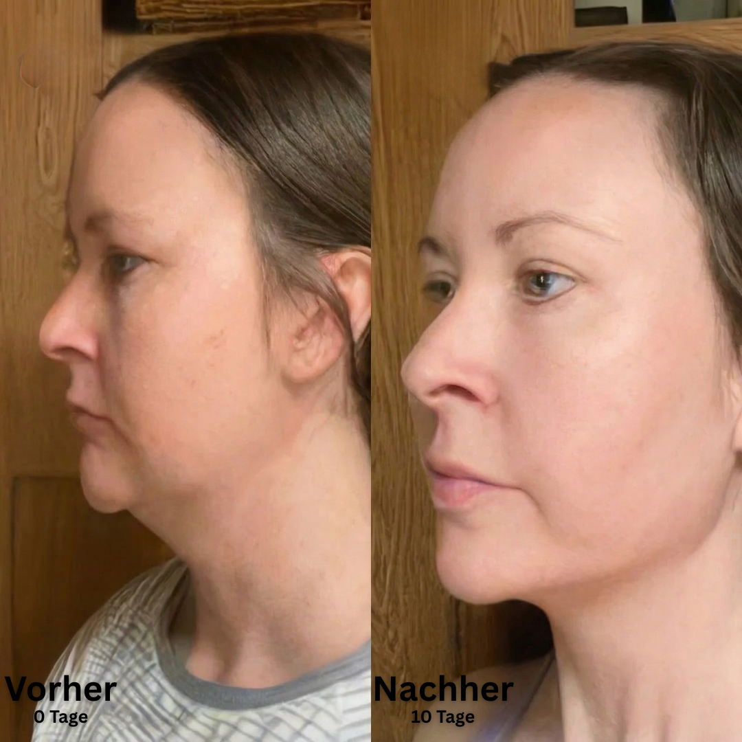 SkinFort Lymphkontur Bürste