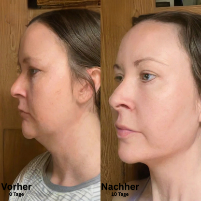 SkinFort Lymphkontur Bürste