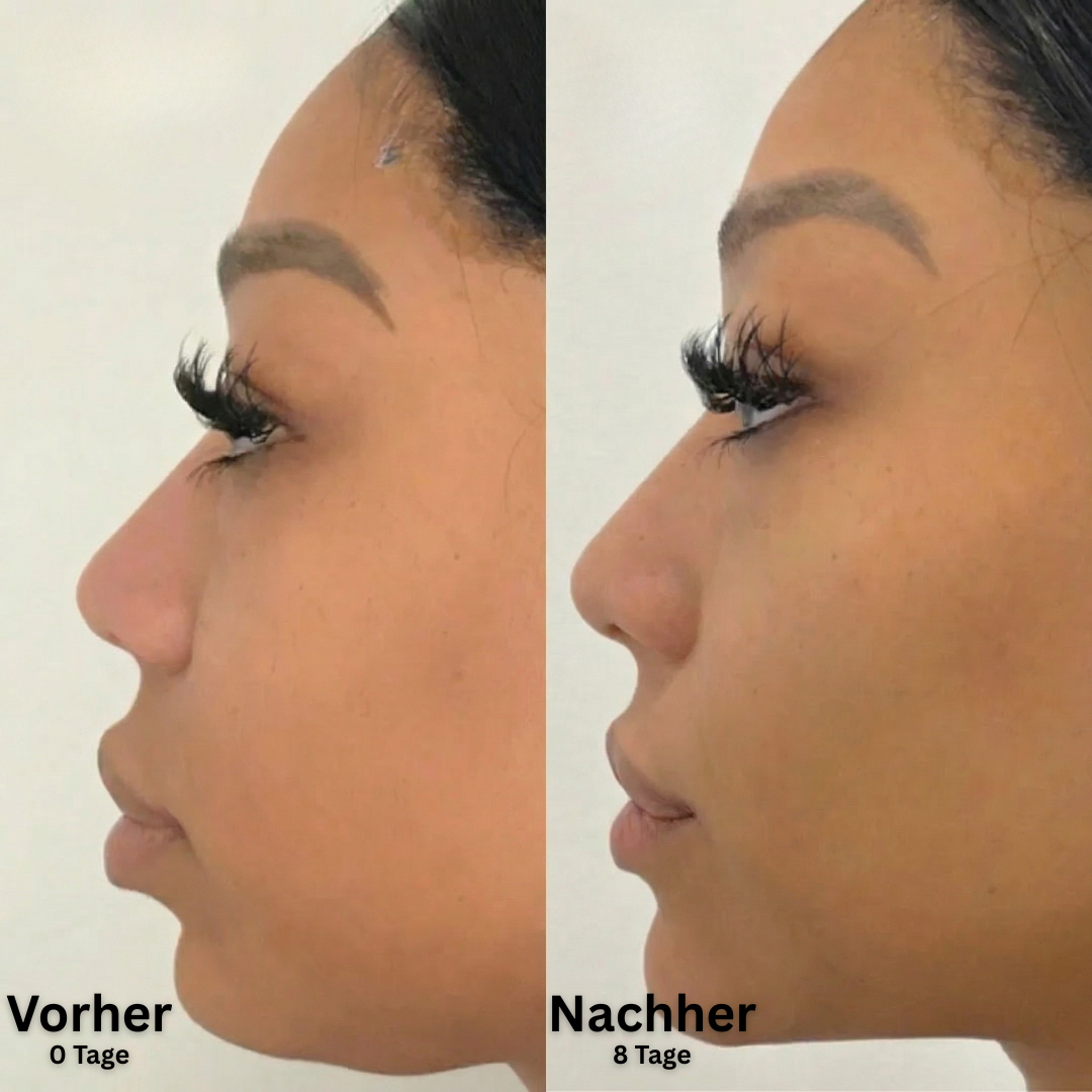 SkinFort Lymphkontur Bürste